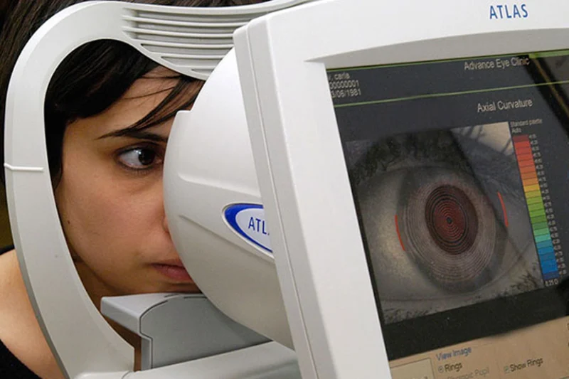 Corneal Measurements